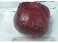 Kỳ lạ bé trai 10 tuổi… mang thai