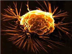 Tế bào ung thư thoát hiểm như thế nào?