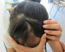 Hà Nội: Cô giáo cầm bút đâm chảy máu đầu học sinh