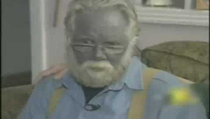 Chữa bệnh cảm quá tay, người đàn ông biến thành bạc