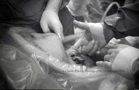 Bé sơ sinh trong bụng mẹ vươn ra nắm tay bác sĩ