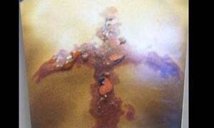 Tự làm bỏng bằng đá và muối, thú vui nguy hiểm của teen