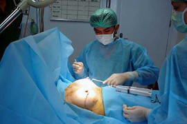 BV Chợ Rẫy cứu 3 phụ nữ suýt chết vì bơm ngực