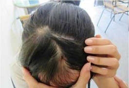 Hà Nội: Cô giáo đâm bút chảy máu đầu HS bị xử lý nặng