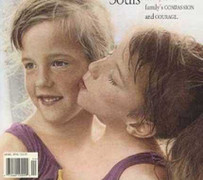 Người 2 đầu xuất hiện ở nhiều nơi trên thế giới