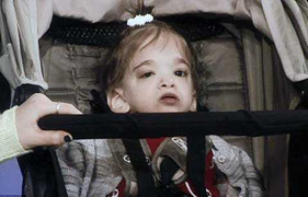 Cô gái 20 tuổi mang hình hài bé 9 tháng tuổi