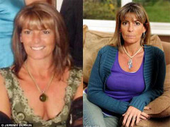 Sau một đêm, răng lung lay, già hơn 10 tuổi