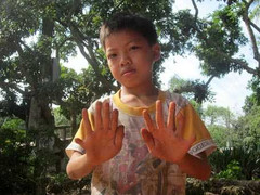 Gia tộc 24 ngón kỳ lạ nhất Việt Nam