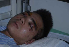 Bạo lực học đường: Một tháng, ba vụ đánh nhau đến chết