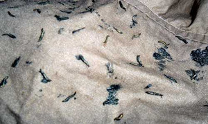 Nghi vấn ‘sinh vật lạ’ trong quần áo