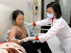 Tự chữa ung thư, nổ khối u vú