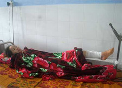 Leo núi đi dạy, cô giáo bị ngã chấn thương nặng