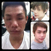 Khủng khiếp ‘hot boy’ hóa ‘dị nhân’ sau tẩy trắng da