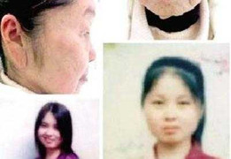 Sinh con xong, cô gái thành bà lão 70