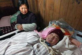 5 năm bóp bóng thở cứu con, bố mẹ biến dạng tay