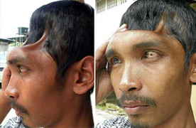 Đầu biến dạng của 'người ngoài hành tinh'