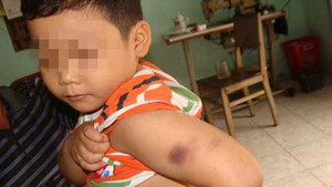 Giây phút giáo viên ‘điên đảo’ với học trò nhí