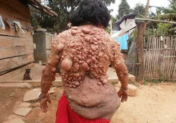 Nỗi đau của người mang thân hình ‘quỷ dữ’