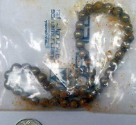 Cấp cứu bé trai nuốt 42 viên nam châm