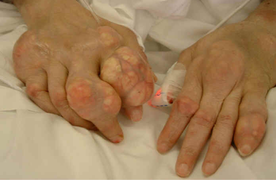 Bí mật bài thuốc chữa bệnh đe dọa nhất với đàn ông