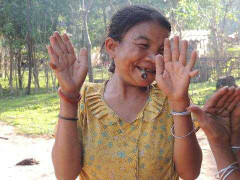 Lạ lùng gia đình 4 người có 104 ngón ở Quảng Bình