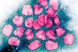 Xuất hiện virus mới giống đại dịch SARS năm 2003