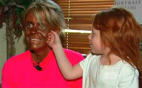 Da trắng miên man biến thành da đen cực xấu