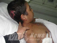 Cậu bé có van tim bị vi khuẩn 'ăn' đang nguy kịch