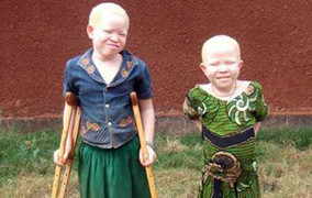 Sự trốn chạy của những người Châu Phi… trắng bóc