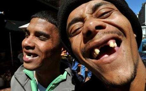 Quái gở mốt nhổ sạch răng cửa cho… hấp dẫn phụ nữ