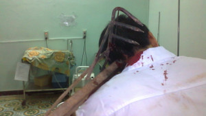 Tấn công tàn bạo công an vì nghi bạn gái yêu người khác