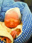 Kỳ lạ bé sơ sinh lông tóc bạc trắng như người già