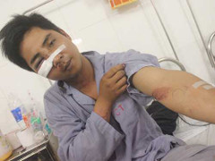 Dựng lại hiện trường vụ 141 bị 'tố' đánh dân