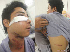 Tổ 141 Hà Nội bị tố đánh dân nhập viện