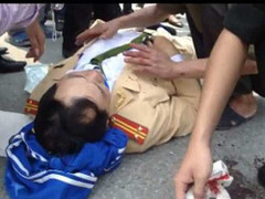 Bắn kẻ chống đối: Cán bộ thường bị tấn công nói gì?