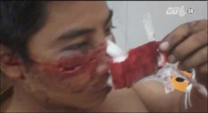 Dân cung cấp thêm chứng cứ tố 141 đánh người