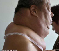 Người đàn ông 'không có cổ'