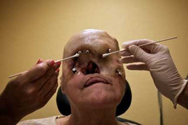 Phút sinh tử của người có gương mặt hơn phim kinh dị