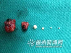 Kỳ lạ mắt cô gái tự sản xuất ra trân châu