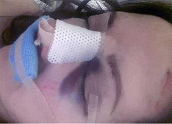 Vì giầy cao gót, sao truyền hình gãy mũi