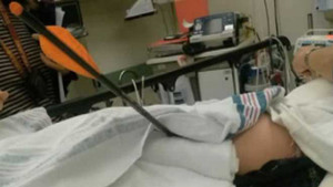 Chơi tại trường, bé 8 tuổi bị tên đâm thấu đùi