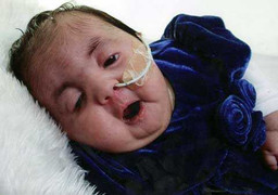 Tiêm móc phin quá liều, 3 bác sĩ bị sa thải