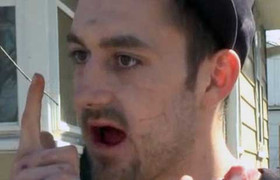 Bi hài: Yêu cầu nhổ 3 răng, bác sĩ nhổ cả hàm