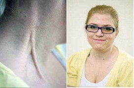 Sống khỏe mạnh nhờ uống chất lỏng từ não