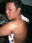 'Hiệp sĩ' máu ướt đẫm người chạy đến đồn công an