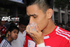 Trung vệ tuyển VN gãy răng cửa