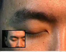 Clip: Rùng mình chữa bệnh bằng giòi sống