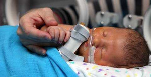 Thương tâm bé sơ sinh mang trong mình đủ thứ bệnh