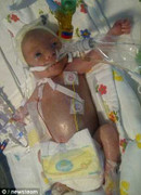 Bác sĩ không rửa tay, 2 bé mất mạng