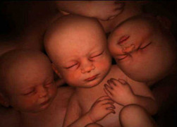 Tò mò ngắm cặp sinh đôi, sinh ba đùa nhau trong bụng mẹ